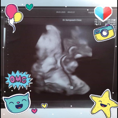 ทีม กรกฎาคมจ้า