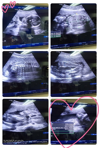 25week1 day