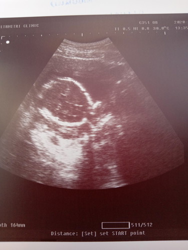 ลุ้นเพศนางก็บังตลอด