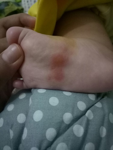 ada yang tau ini kenapa bund