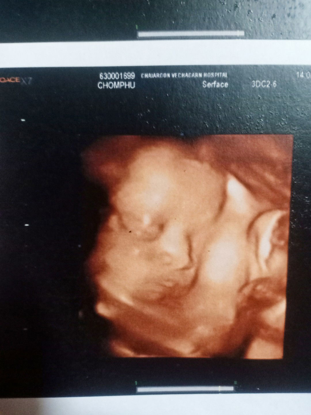 Chompoonut Meewong profile icon