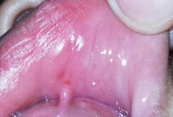 Sakit Ng Tyan Ng Batang 4yrs Old