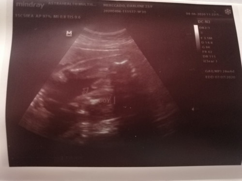 GENDER CONFIRMATION