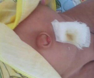 pusat muncul daging ini setelah pusat pupus