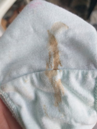 BROWN DISCHARGE AT 7 WEEKS