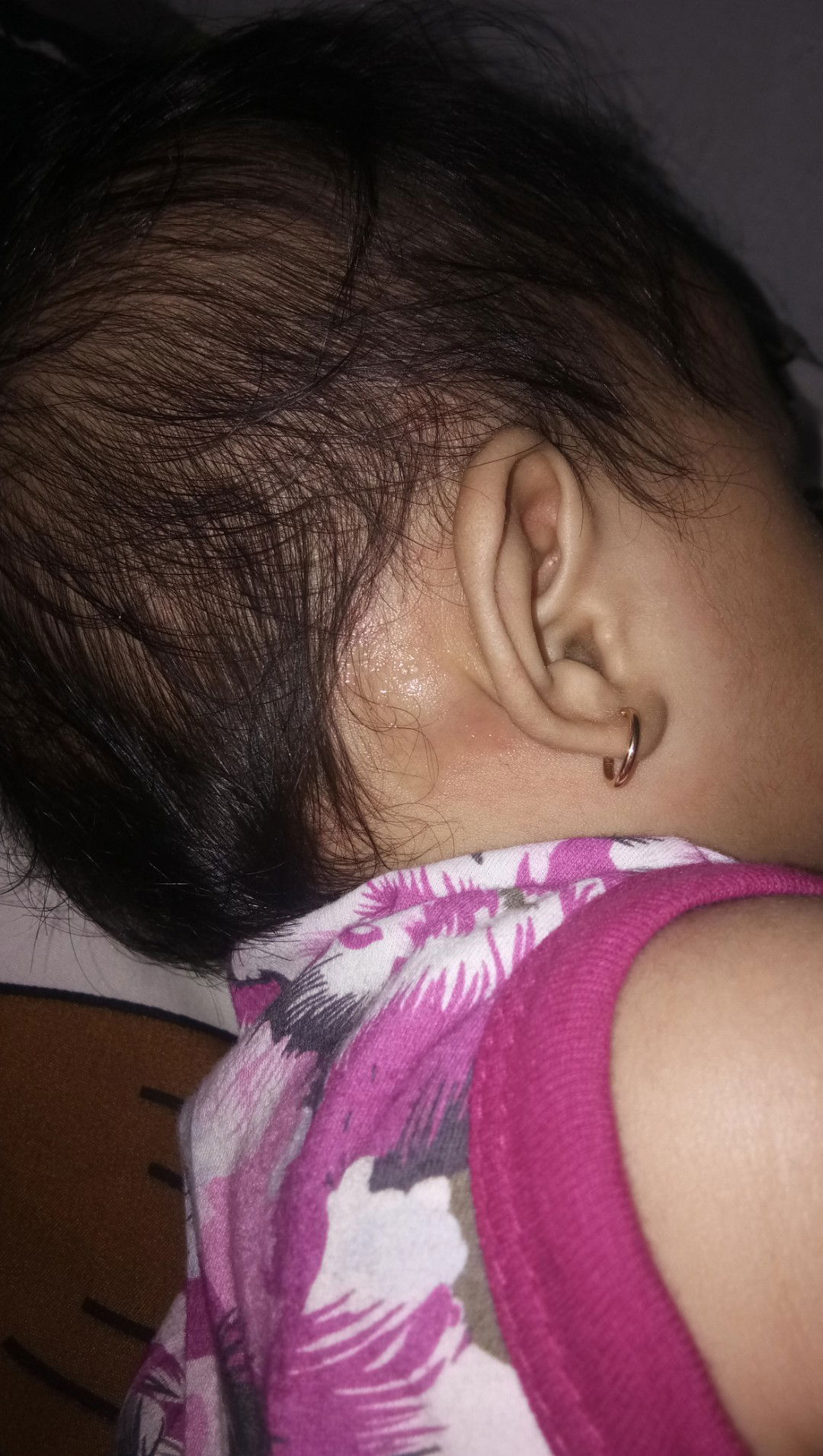 benjolan d belakang telinga