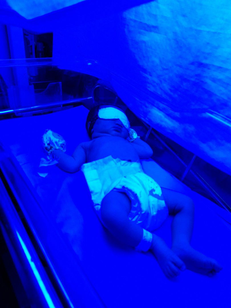 14/12/62 11:11 ลูกโดนจับฉายแสง