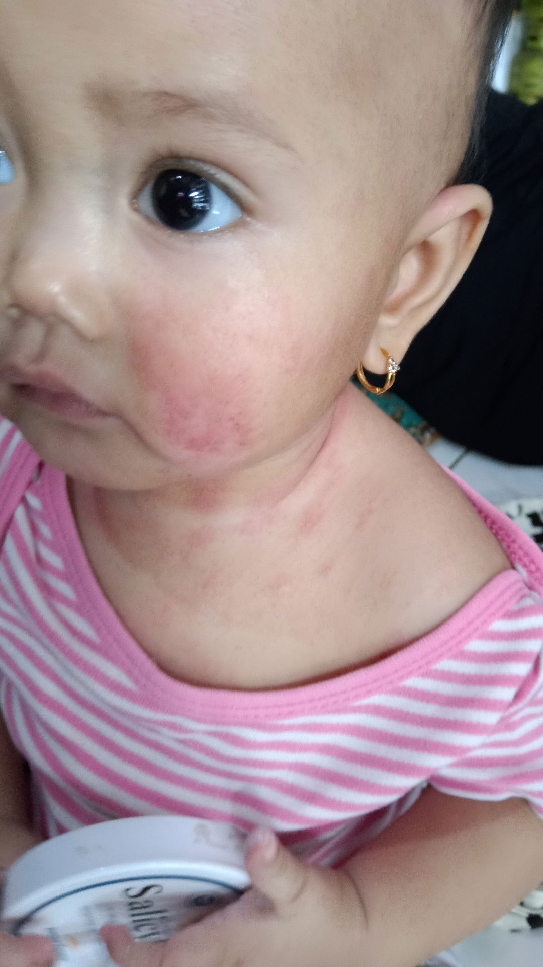 harus ke SpA atau SpKK