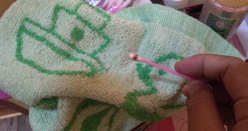 มีเลือดออก