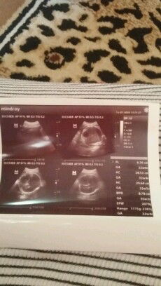 sangat bersyukur dan bahagiaa 💜😘