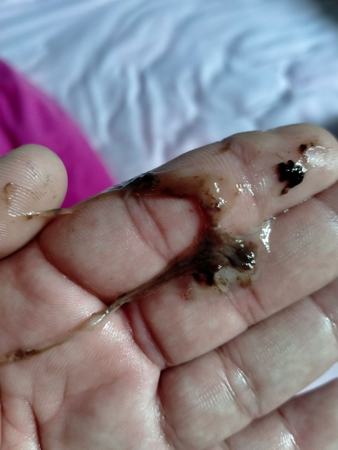 กังวลเกินไปเลยทำให้เลือดออก