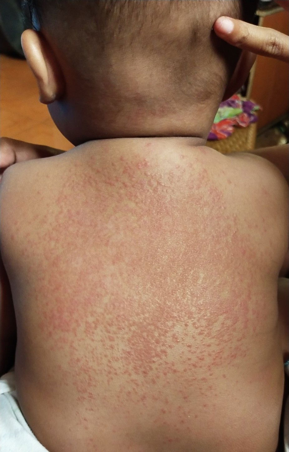 bingung mau k dokter tp lg pandemic