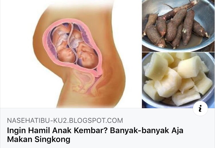 Anak kembar