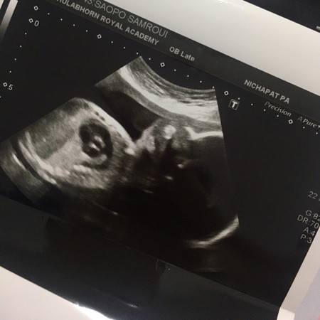Baby ??