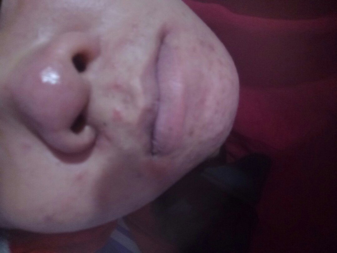 Bầu 38w