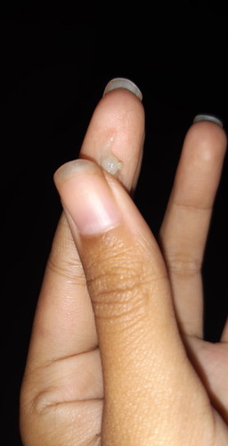 เจ็บนิดๆ