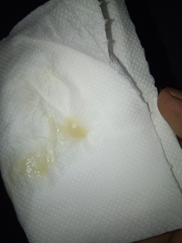 white mens or mucus plug??