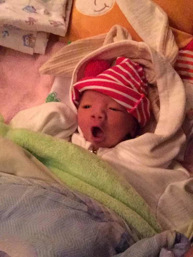 เด็กทารกวัย5วัน เกิดก่อนกำหนด2เดือน