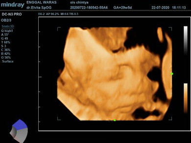 baby boy 😘😘
