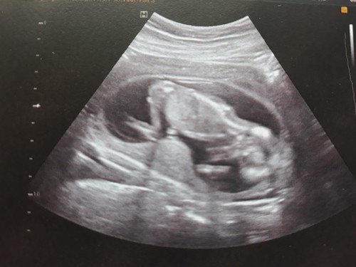 มีบ้านไหนนอนท่านี้ไหมคะ หนีบไว้ไม่โชว์แม่เลย