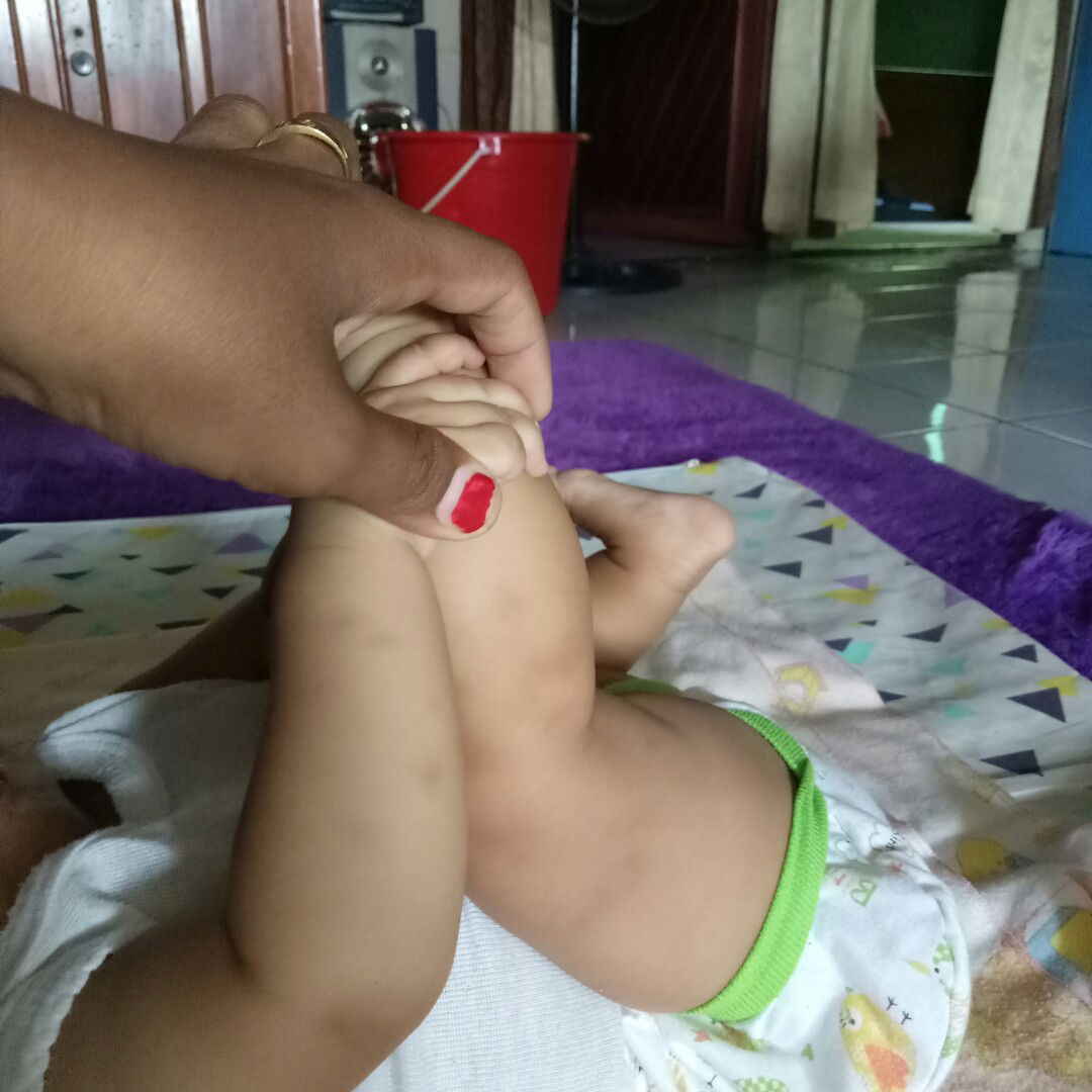 bekas hitam gigitan nyamuk