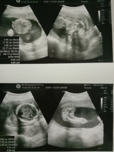 ดูไม่ออกว่า เพศ ญรึช ใครดูออกบ้างคะ