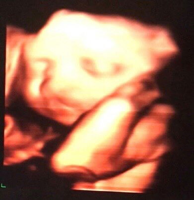 สวัสดีค่ะ ทีม สิงหาคะ