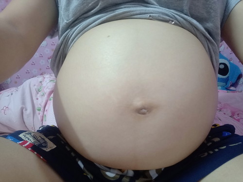 ปวดไปทั้งตัว