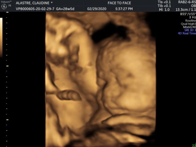 Our cutie chubby cheeks baby girl