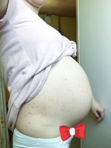 Tummy Size
