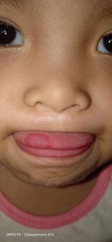 something sa dila nang baby qoh