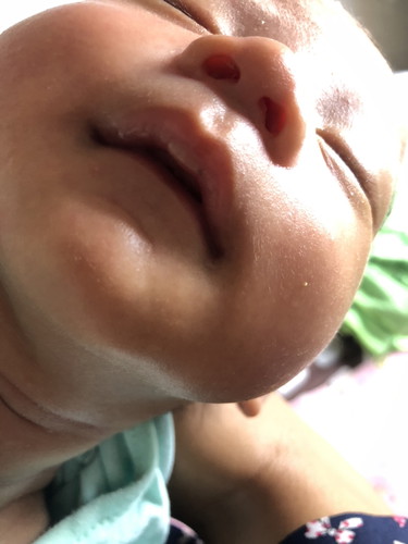 ลูกบ้านไหนเป็นไหมค่ะ