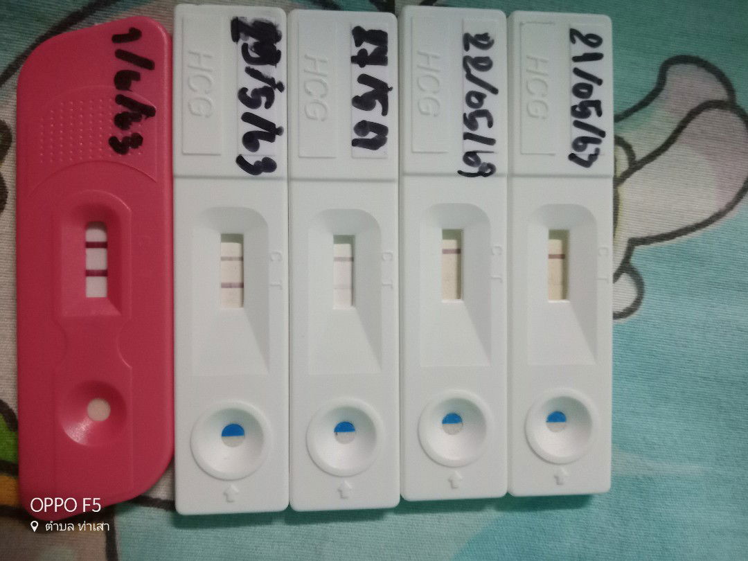 ตรวจครรภ์ขึ้น2ขีดแต่หมอบอกไม่ท้อง