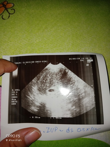 ท้องได้5สัปดาห์มีเลือดไหลนิดหน่อย