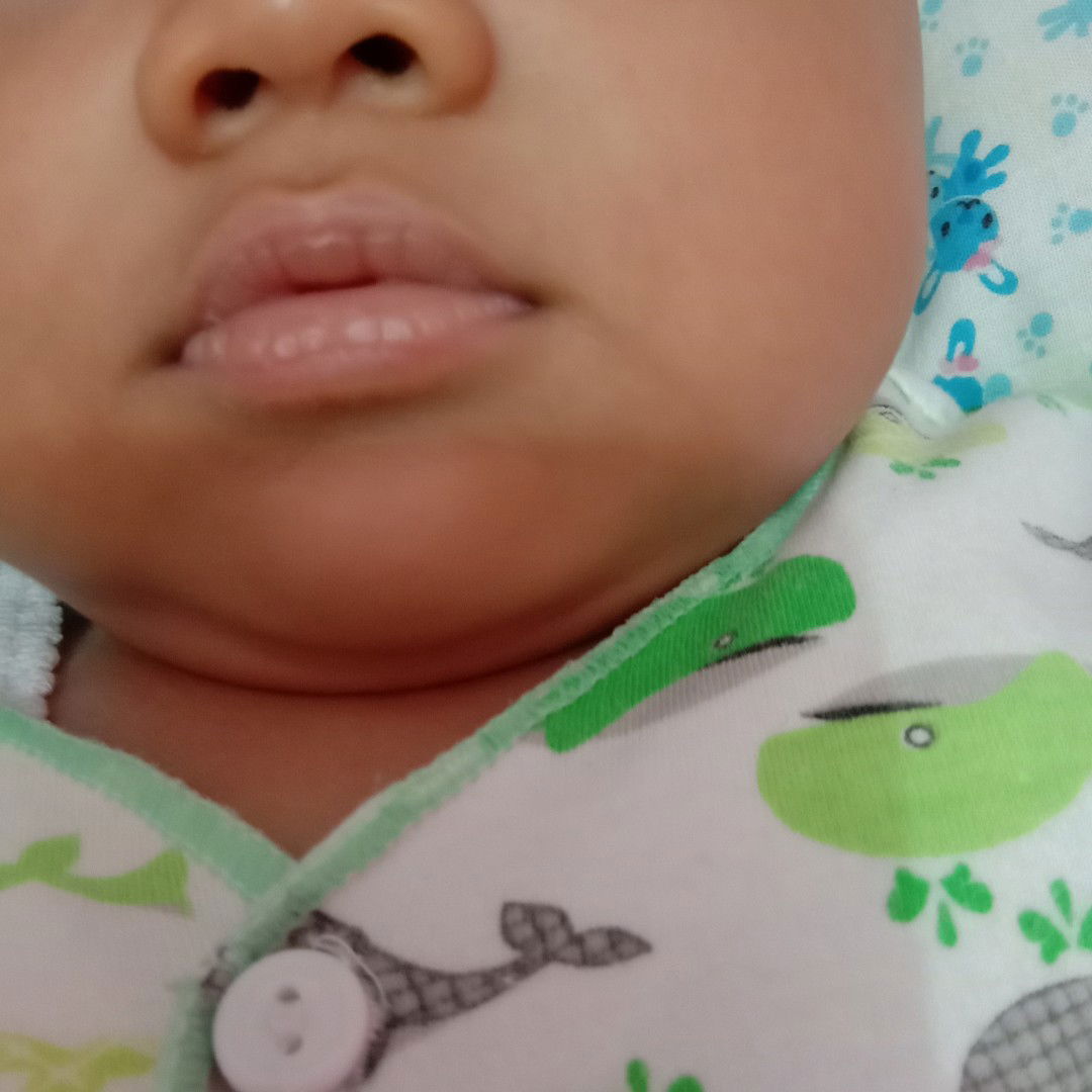 ada yg pernah alamin nggak bun?