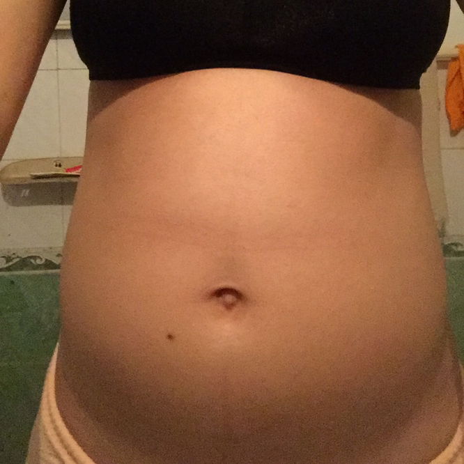 Bầu này các mom đoán trai hay gái?