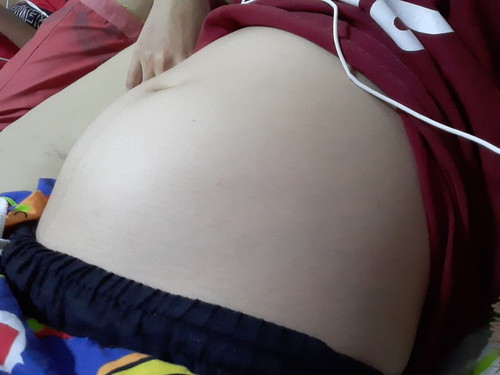 น้ำหนักไม่ขึ้น