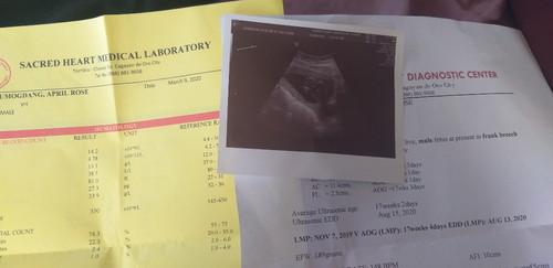 gender ultrasound