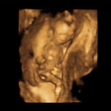 si dede aktif banget?