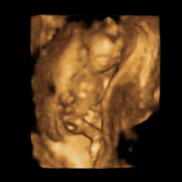 si dede aktif banget?