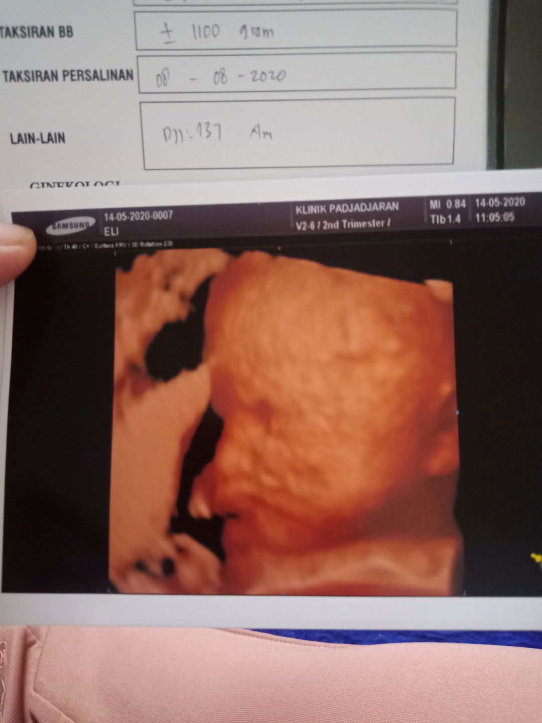 Hasil usg 26week