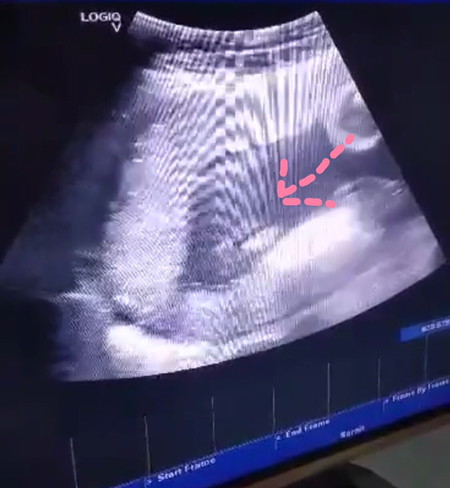 ได้ลูกสาวหรือลูกชายกันค่ะแม่ๆ ☺️ เอารูปมาอวดกันหน่อยค่ะ