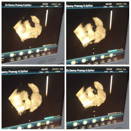 Ayunilla profile icon