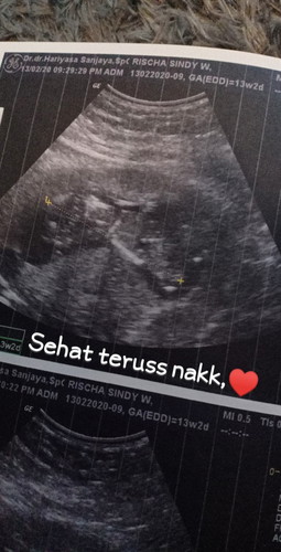hasil usg