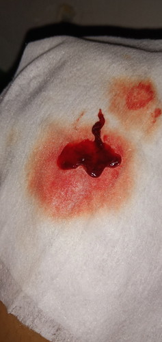 keguguran apa bukan ya?