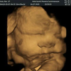 Pince Situmorang profile icon