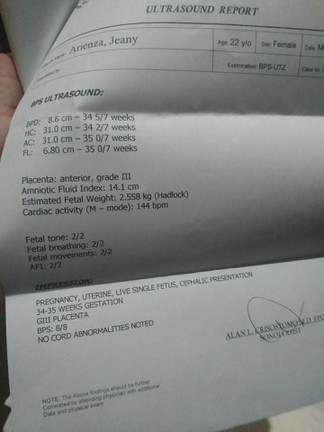 Pwede naba ko manganak?