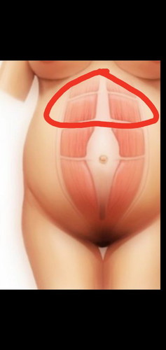 ปวดท้องค่ะ