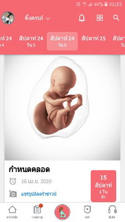 กำหนดคลอด