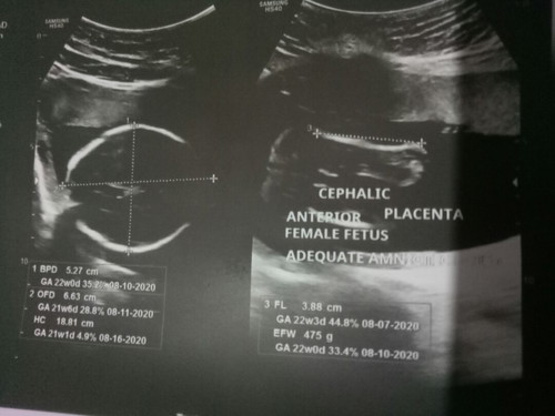 ultrasound question